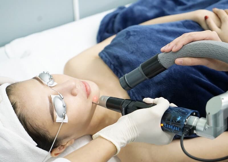 Nám mảng là gì? Hướng dẫn 4+ cách điều trị nám mảng hiệu quả